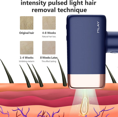 Mlay™ T14 IPL Hair Removal Device